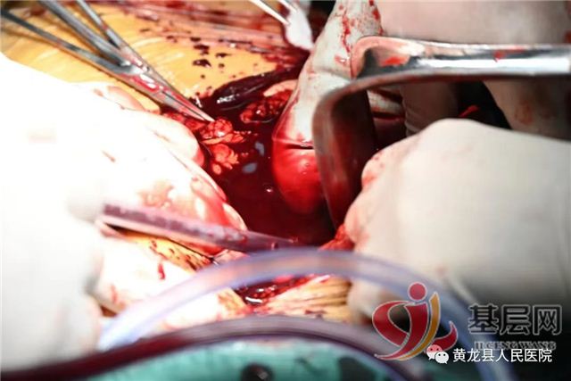 22535430031776485_68.jpg 22535430031776485_68.jpg