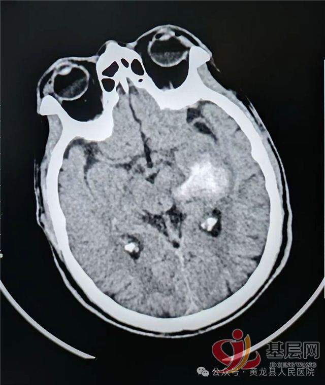 11255660325091826_68.jpg 11255660325091826_68.jpg