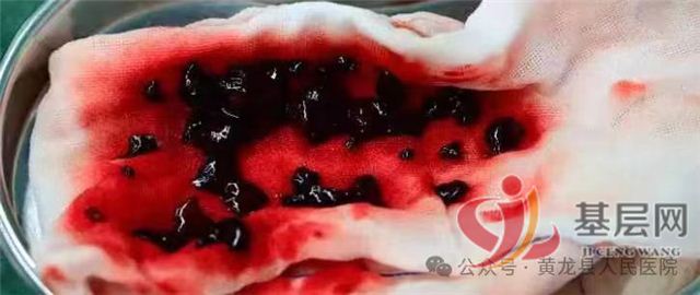 11271081261693233_68.jpg 11271081261693233_68.jpg