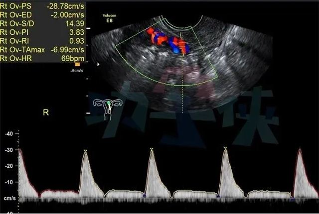 18483244819222041_103.jpg 18483244819222041_103.jpg