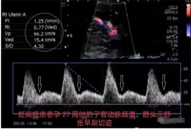 18484876573360558_103.jpg 18484876573360558_103.jpg