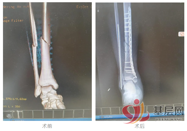 1638045694163125_137.png 1638045694163125_137.png